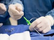 Cateterismo: precisión diagnóstica para la salud del corazón