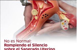 Sangrado uterino anormal afecta al 30% de las mujeres